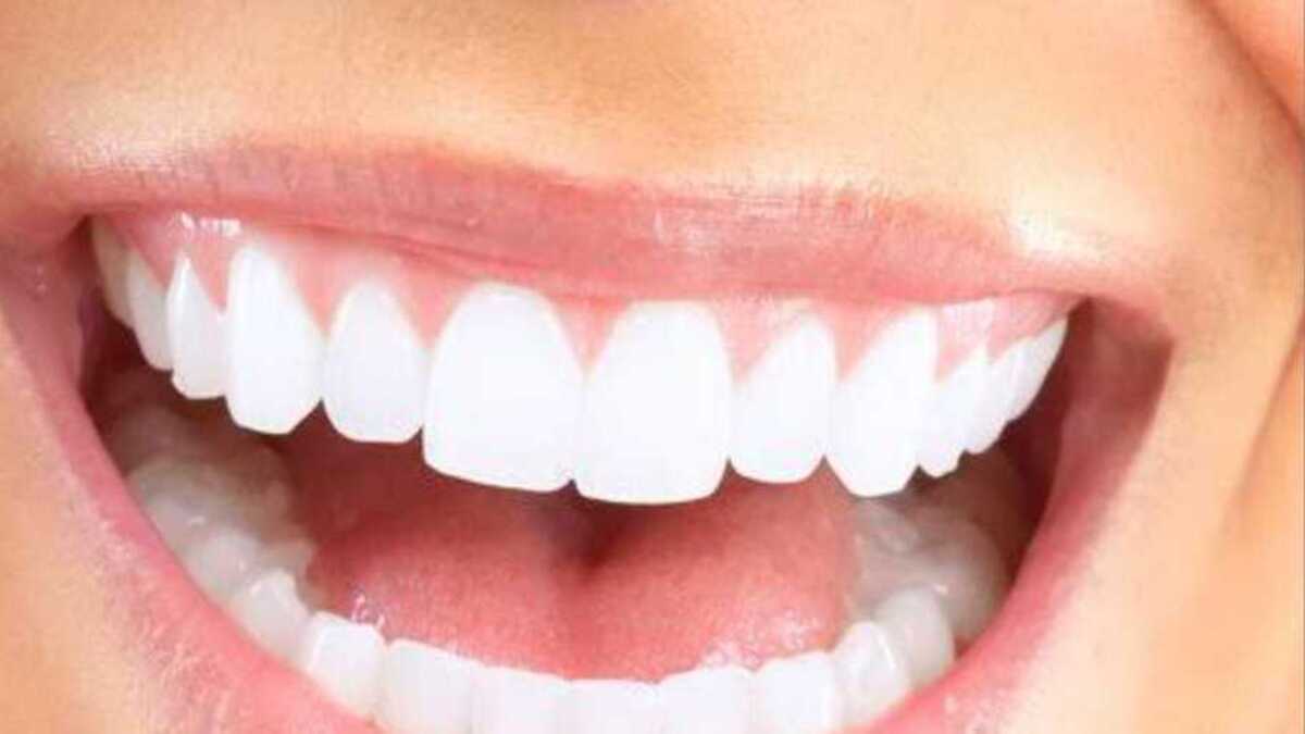 Ternyata Memutihkan Gigi bisa Menggunakan Bahan Alami Loh! Yuk, Simak Penjelasannya