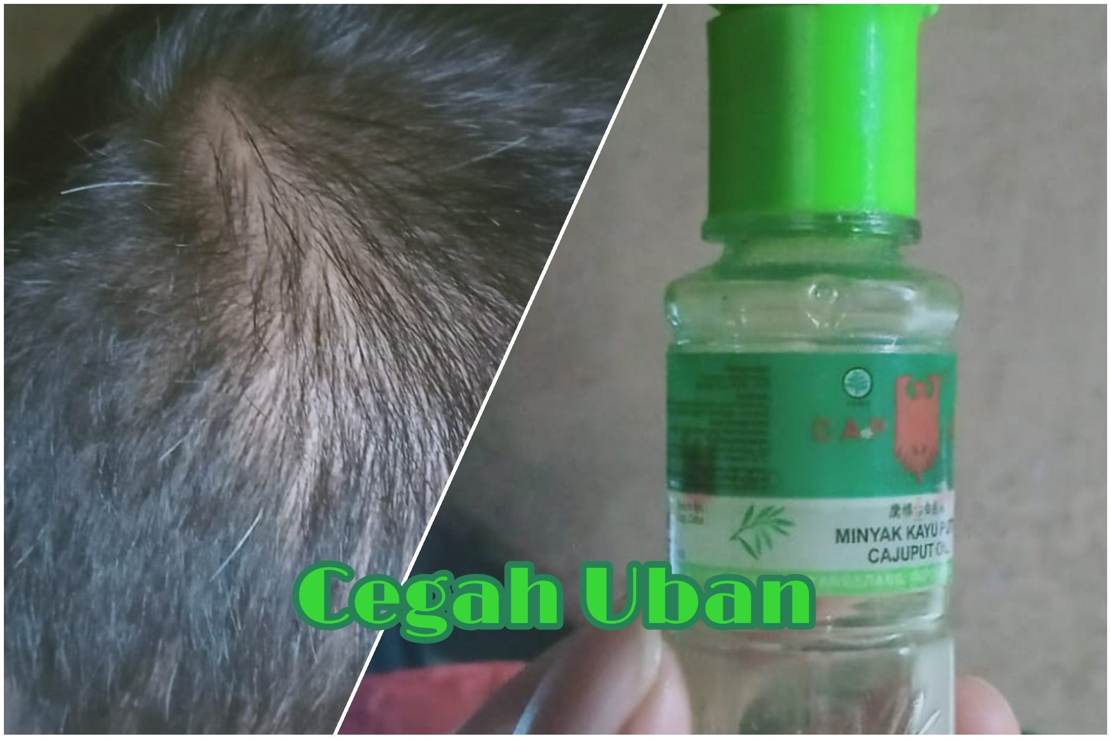 Cara Menggunakan Minyak Kayu Putih Cap Lang untuk Menghilangkan Uban Secara Permanen Hingga ke Akar