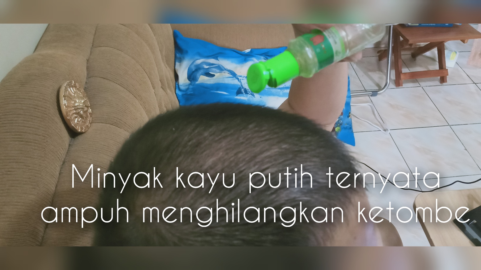 Serbuk Putih Berjatuhan di Bahu Itu Bernama Ketombe, Menghilangkannya Pakai Minyak Kayu Putih Aja