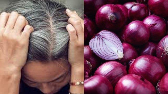 Ingin Uban Hilang dan Rambut Hitam Alami? Pakai Bawang Merah Aja, Hemat dan Gampang Didapat, Begini Caranya