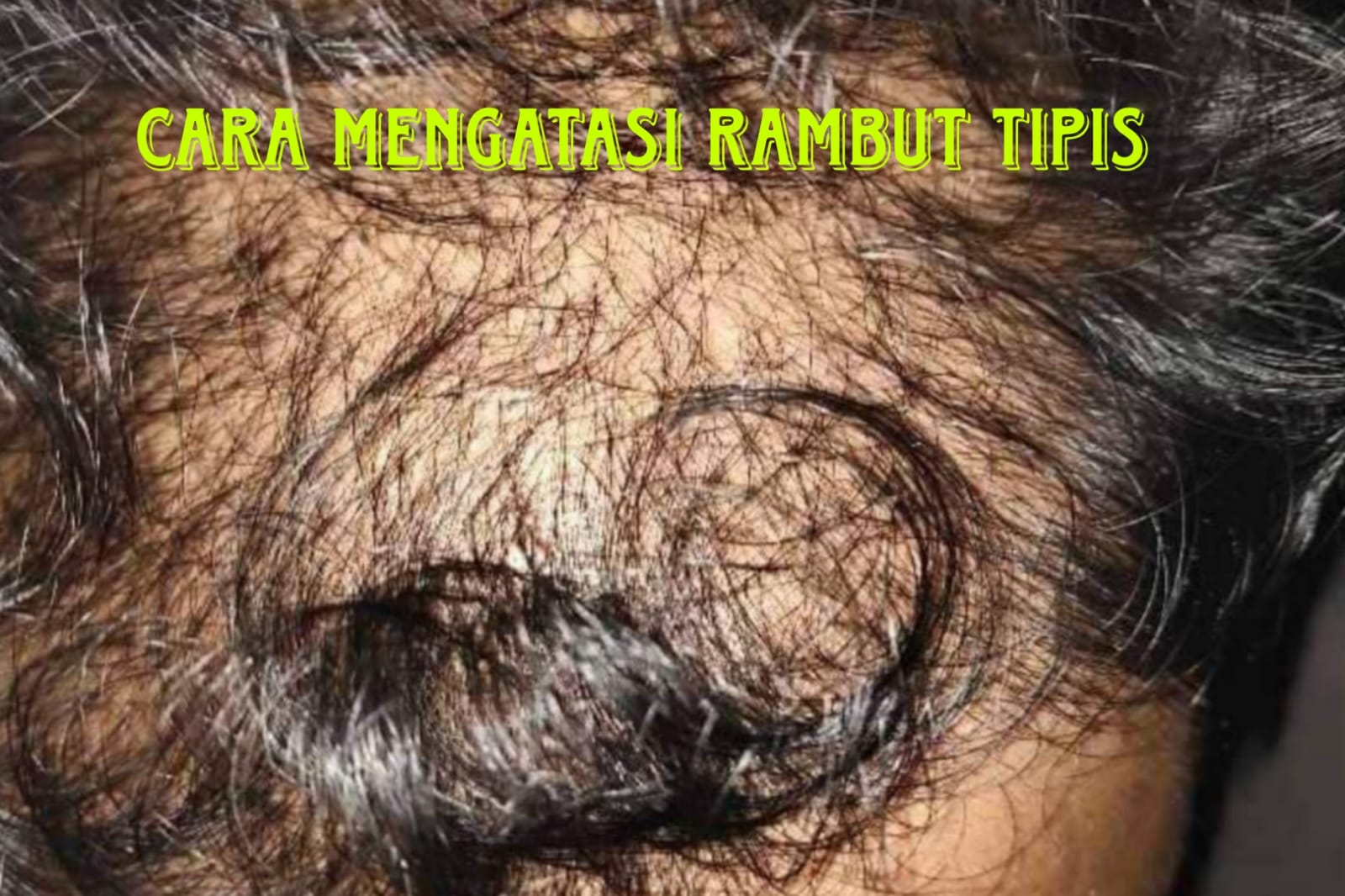 Rambut Perlahan Menipis? Jangan Khawatir, Ini 4 Cara Alami untuk Mengatasinya, Jadikan Rambut Tebal dan Sehat