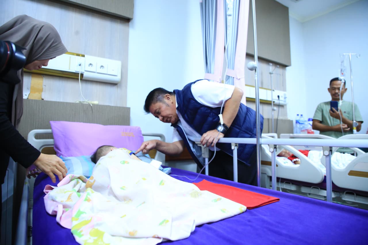 Gubernur Tekankan Pendataan Menyeluruh Penderita Celah Bibir dan Langit-Langit di Sumsel