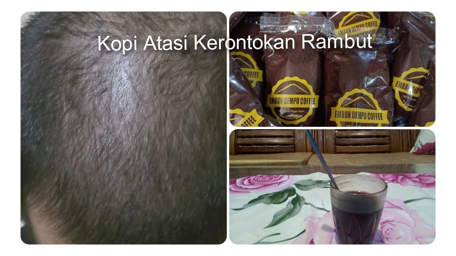 Ternyata Kopi Juga Menyehatkan Rambut dan Cegah Kerontokan