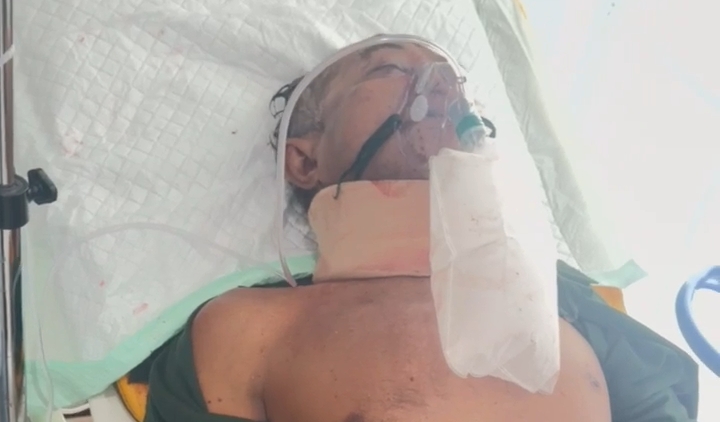 Masuk Lubang di Jalan Lintas Sumatera Muara Enim, Pengendara Sepeda Motor Revo Alami Luka Berat