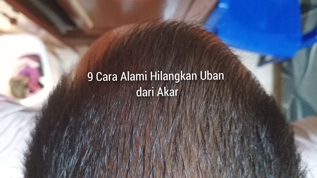 9 Cara Alami dan Mudah Hilangkan Uban dari Akar, Bukan Dicabut atau Dicat! 