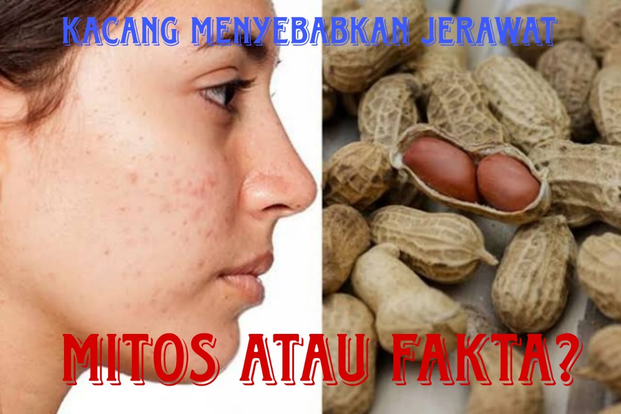 Benarkah Sering Makan Kacang Menyebabkan Jerawatan? Simak Ini Penjelasannya