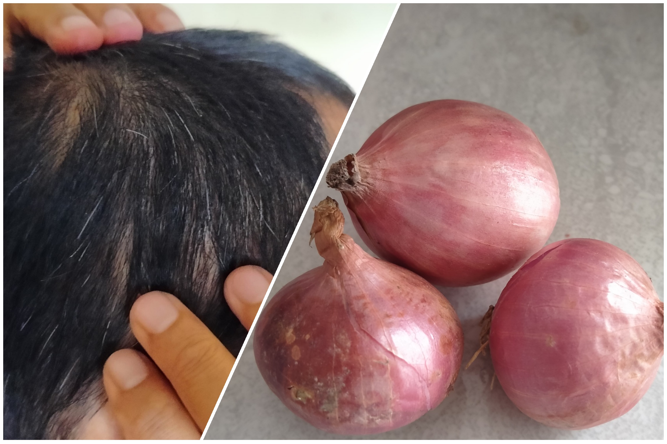 Cara Menggunakan Bawang Merah Untuk Hilangkan Uban dan Jadikan Rambut Hitam Alami