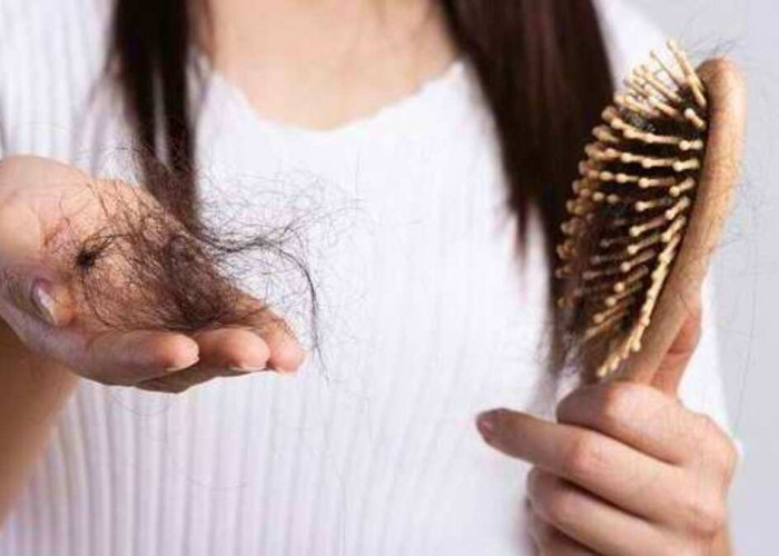 Rambut Anda Sering Rontok dan Membuat Stres? Jangan Panik! Begini Cara Mengatasinya