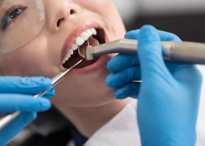 Kamu Harus Tahu, Ternyata BPJS Kesehatan Bisa Dipakai Buat Membersihkan Karang Gigi Loh
