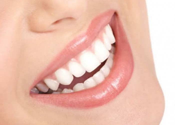 6 Cara Memutihkan Gigi Secara Alami