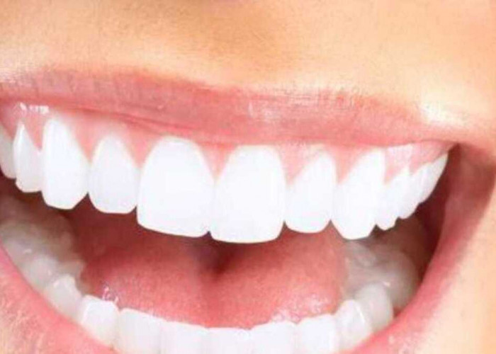 Ternyata Memutihkan Gigi bisa Menggunakan Bahan Alami Loh! Yuk, Simak Penjelasannya