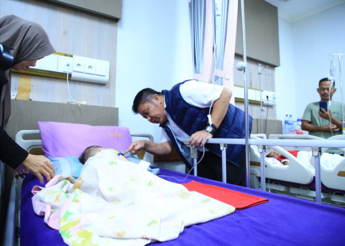 Gubernur Tekankan Pendataan Menyeluruh Penderita Celah Bibir dan Langit-Langit di Sumsel