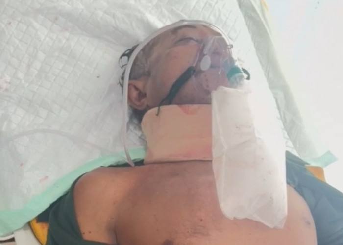 Masuk Lubang di Jalan Lintas Sumatera Muara Enim, Pengendara Sepeda Motor Revo Alami Luka Berat