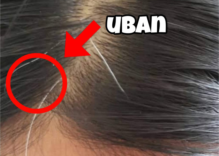 Gak Usah Dicabut dan Dicat Rambut, Ini 9 Cara Alami untuk Menghilangkan Uban dari Akarnya