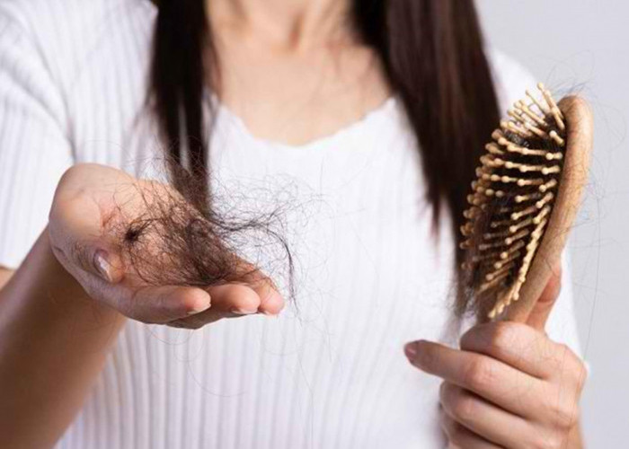 Kenali Kerontokan Rambut yang Sering Terjadi, Apa Bahayanya?