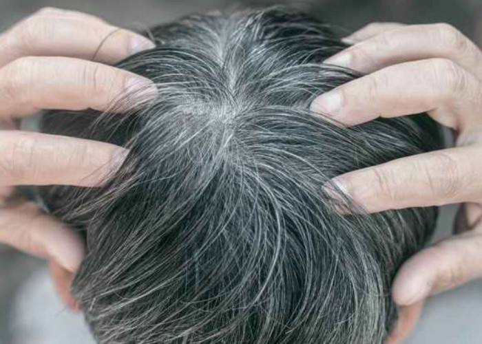 Hilangkan Uban Secara Permanen Pakai Minyak Kayu Putih Cap Lang, Begini Caranya