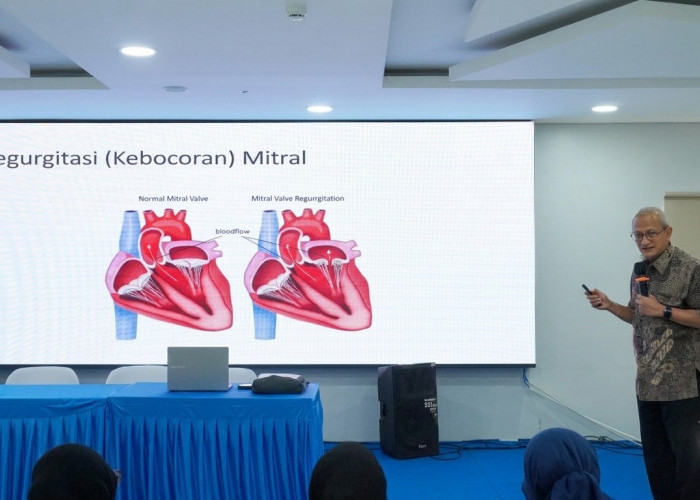 Hadirkan MitraClip, Harapan Baru Bagi Pasien Kebocoran Katup Jantung Berisiko Tinggi