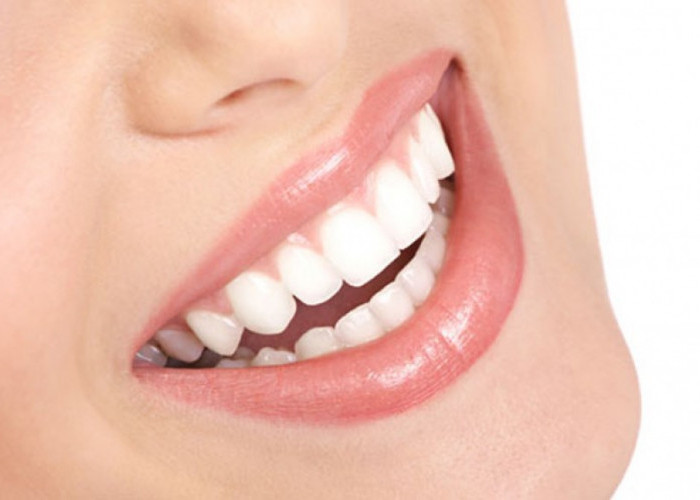 Ingin Memiliki Gigi Putih Alami? Gunakan Bahan Alami Ini, Dijamin Gigi Putih Seketika