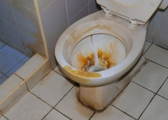 Tanpa Detergen, Ini 7 Bahan Alami yang Dapat Membersihkan Kerak Kuning di Toilet, Diantaranya Belimbing Wuluh