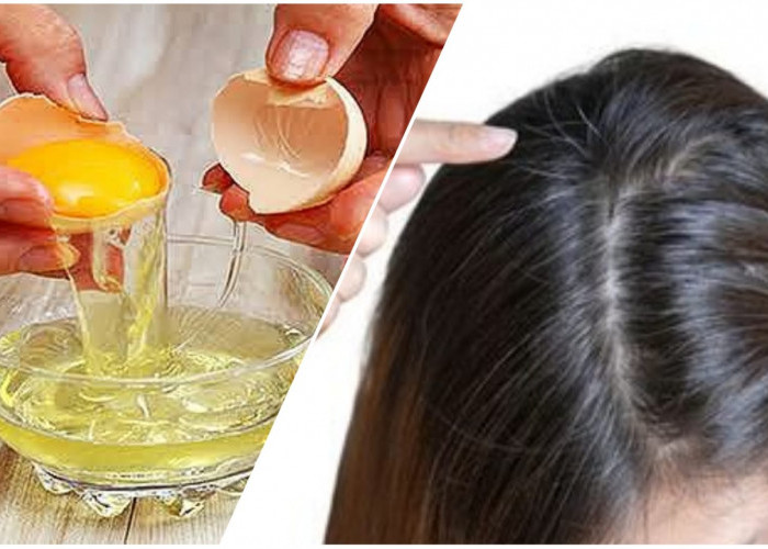 Cara Mengatasi Uban dengan Putih Telur, Dijamin Rambut Jadi Hitam Mengkilat 