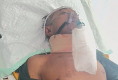 Masuk Lubang di Jalan Lintas Sumatera Muara Enim, Pengendara Sepeda Motor Revo Alami Luka Berat